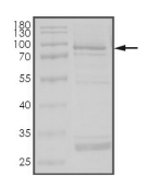 DYRK4 Protein, Human, Recombinant (GST)