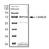CAMK2D Protein, Human, Recombinant (GST)