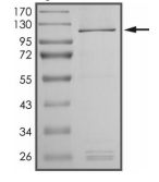 DGKG Protein, Human, Recombinant (GST)