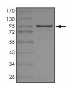 CASK Protein, Human, Recombinant (GST)