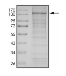 C-ABL/ABL1 Protein, Mouse, Recombinant (His)