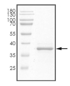 STUB1 Protein, Human, Recombinant (His)