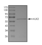 ALK-2/ACVR1 Protein, Human, Recombinant (GST)