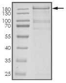 DGKK Protein, Human, Recombinant (His)