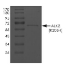 ALK-2/ACVR1 Protein, Human, Recombinant (R206H, GST)