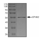 EphB2 Protein, Human, Recombinant (aa 611-893, GST)