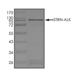 STRN-ALK Protein, Human, Recombinant (Sex3Aex20, GST)
