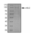 ABL2 Protein, Human, Recombinant (His)
