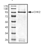 CHEK2 Protein, Human, Recombinant (Active, GST)