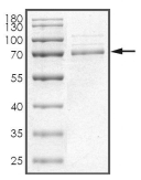 EGFR Protein, Human, Recombinant (aa 668-1210, His)