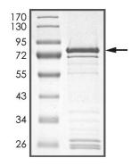 AAK1 Protein, Human, Recombinant (GST)