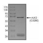 ALK-2/ACVR1 Protein, Human, Recombinant (G328E, GST)