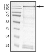 DGKH Protein, Human, Recombinant (GST)