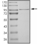 DGKG Protein, Human, Recombinant (aa 1-791, His)
