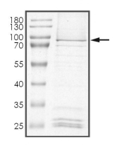 DGKE Protein, Human, Recombinant (GST)