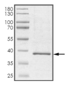 CDK6 Protein, Human, Recombinant (His)