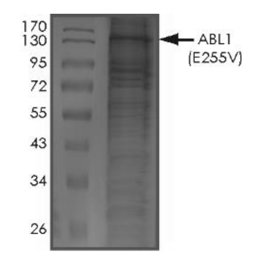 C-ABL/ABL1 Protein, Human, Recombinant (E255V, His)