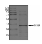 eIF2alpha/EIF2S1 Protein, Human, Recombinant (His)