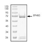 EphB3 Protein, Human, Recombinant (GST)