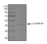 CDKN2A/p16INK4a Protein, Human, Recombinant (GST)