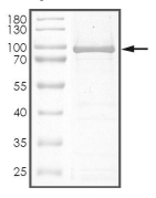 AKT1 Protein, Human, Recombinant (E17K, GST)
