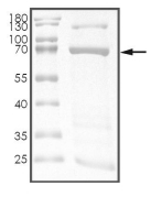 AURORA A, Human, Recombinant (GST)