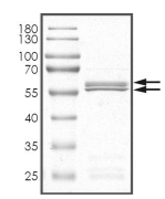 CDK4 & Cyclin D1 Protein, Human, Recombinant (GST)