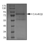 CAMKII beta/CAMK2B Protein, Human, Recombinant (GST)