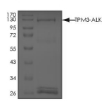 TPM3-ALK Protein, Human, Recombinant (GST)