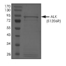 ALK Protein, Human, Recombinant (S1206R, GST)