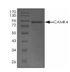 CAMKIV Protein, Human, Recombinant (Active, GST)