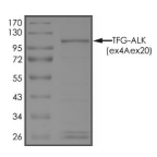 TFG-ALK Protein, Human, Recombinant (Tex4Aex20, GST)