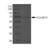 Cyclin O/CCNO Protein, Human, Recombinant (GST)