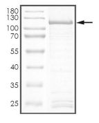 HER2/ERBB2 Protein, Human, Recombinant (GST)