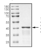 ARPP19 Protein, Human, Recombinant (GST)
