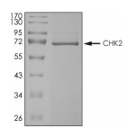 CHEK2 Protein, Human, Recombinant (His)