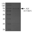ALK Protein, Human, Recombinant (C1156Y, GST)