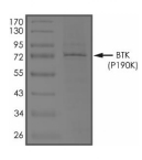 BTK Protein, Human, Recombinant (P190K, His)