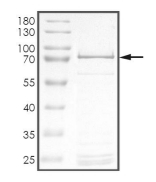 ADCK3 Protein, Human, Recombinant (GST)