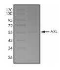 AXL, Human, Recombinant (aa 473-894, His)