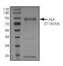 ALK Protein, Human, Recombinant (T1151M, GST)