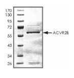 ACVR2B Protein, Human, Recombinant (GST)